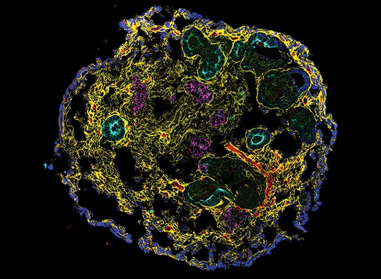 False-coloured image of a kidney organoid
