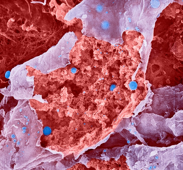 Coloured scanning electron micrograph (SEM) of influenza (flu) viruses (blue) budding from a burst epithelial cell.