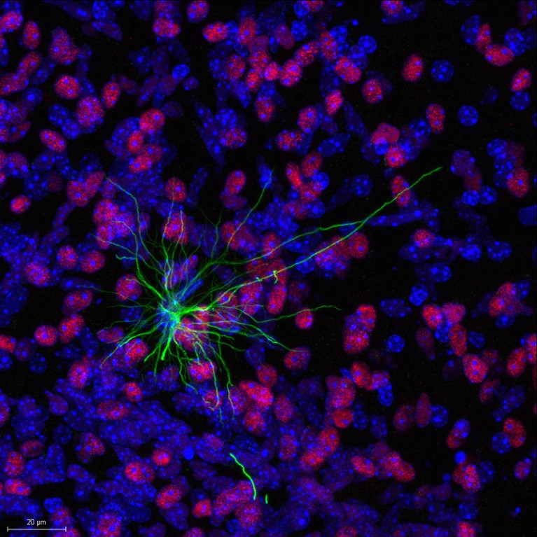 A human astrocyte (green) that has migrated and engrafted into the mouse olfactory bulb.