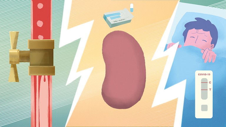 An illustration showing medication, COVID-19 and a blocked blood vessel as three causes for CKD.