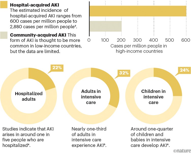 Bar and pie charts showing the incidence of hospital-acquired acute kidney injury in adults and children