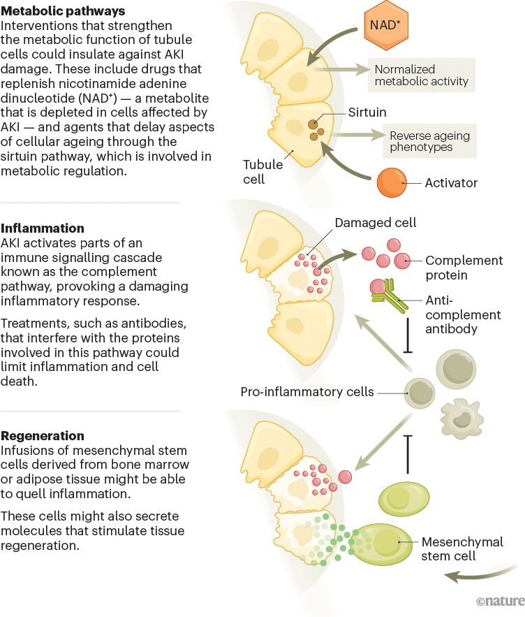 Graphic describing opportunities for treating and preventing acute kidney injury