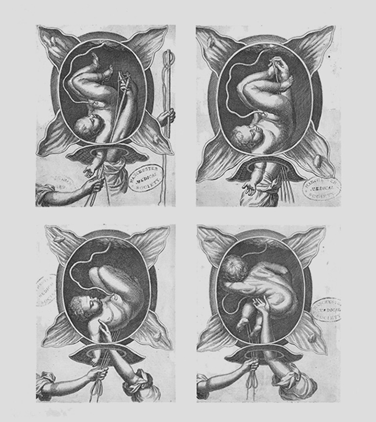 Illustration of child in utero.