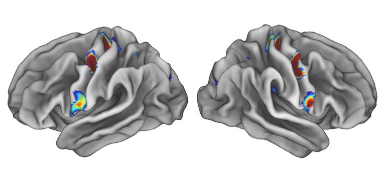Illustration of grey brains with patches highlighted in a spectrum of colours.