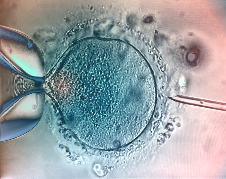 Light micrograph of a micro-needle (right) and pipette being used to fertilise a human egg cell during the process of IVF.
