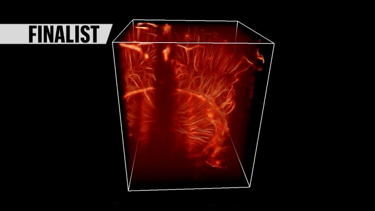 A 3D ultrasound image of blood flow on a black background