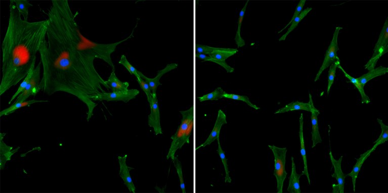 两个图像细胞染成红色,蓝色或绿色显示不同级别的衰老的活动