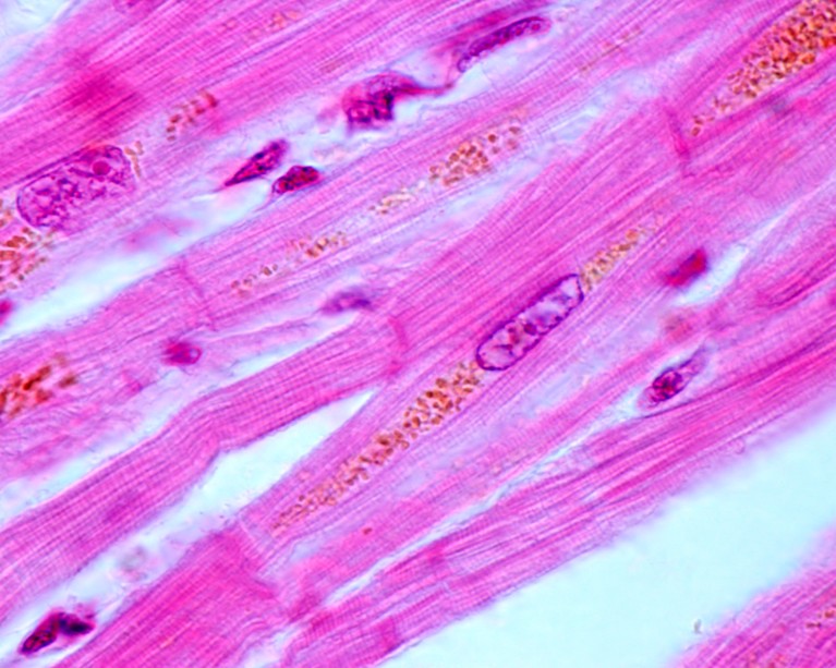 High magnification light micrograph showing heart myocytes longitudinally sectioned in pink