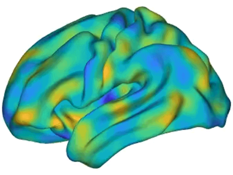 Animated sequence of multicoloured brainwaves moving across the brain surface during a resting state.