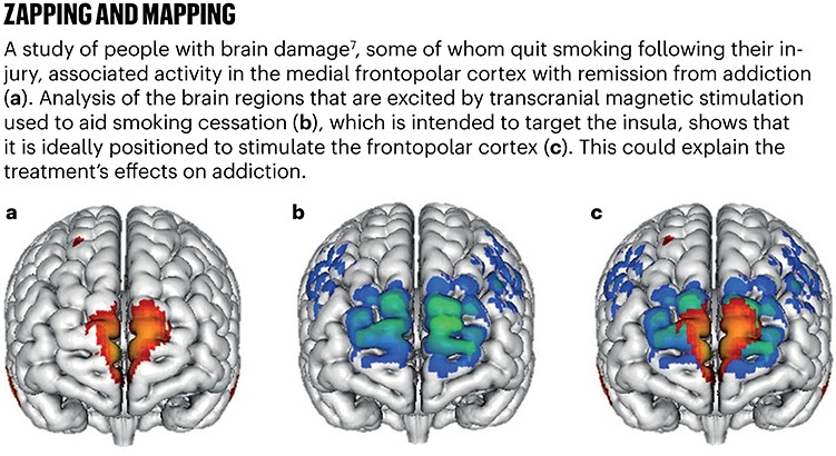Three brain images show activity from transcranial magnetic stimulation overlaps areas involved in remission from addiction.