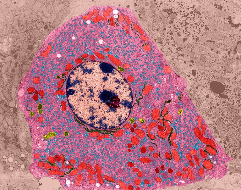 Coloured transmission electron micrograph of a liver cell.