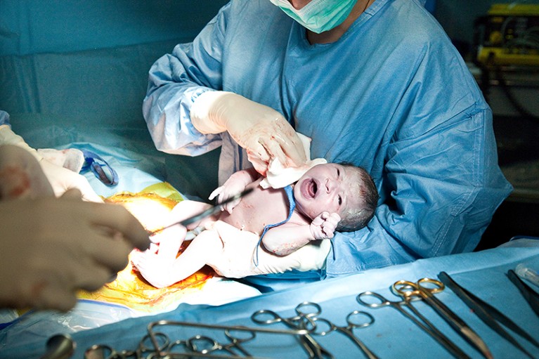 新生儿在科钦医院在巴黎,法国。