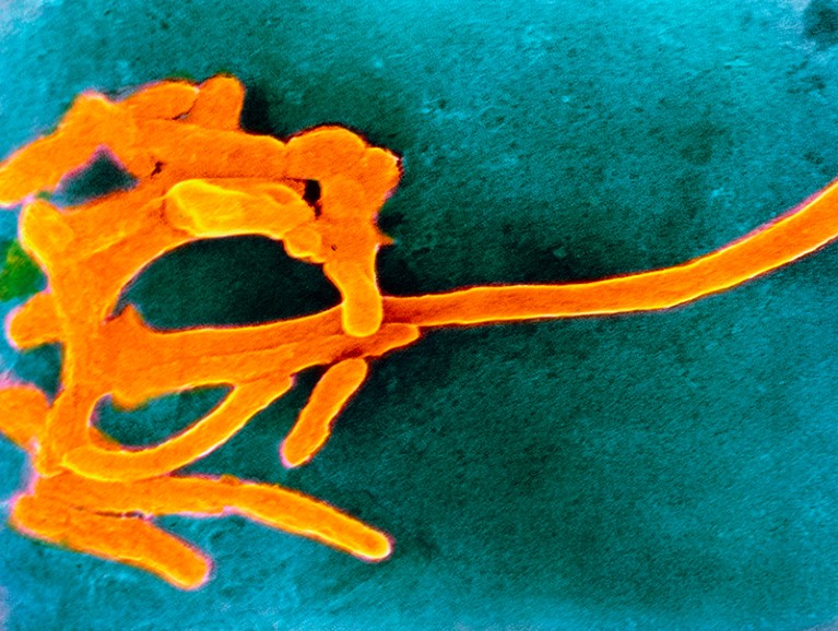 False-colour scanning electron electron micrograph of Fusobacterium nucleatum.