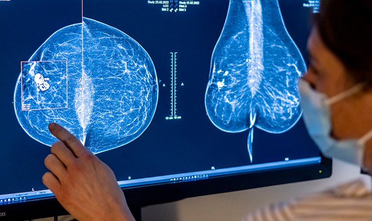 A medical staff member examines a mammogram image.