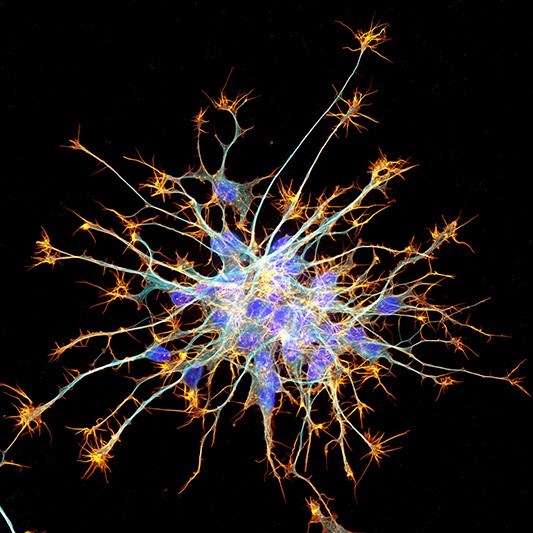 A fluorescence light micrograph of neurons from stem cells.