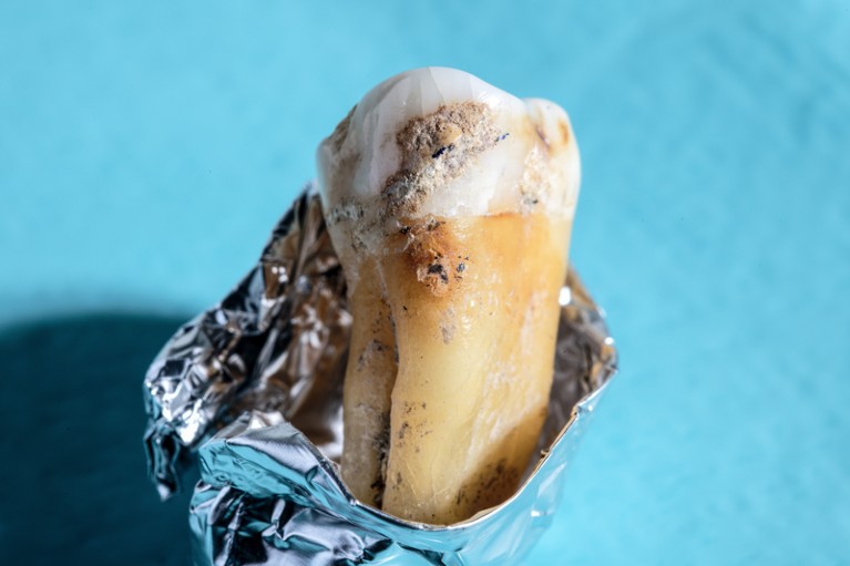 A close-up of a tooth wrapped in foil on a pale blue background