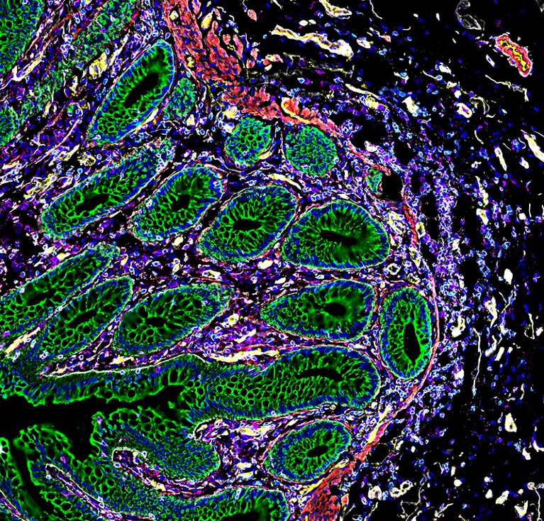 HuBMAP image of cells in the intenstine.