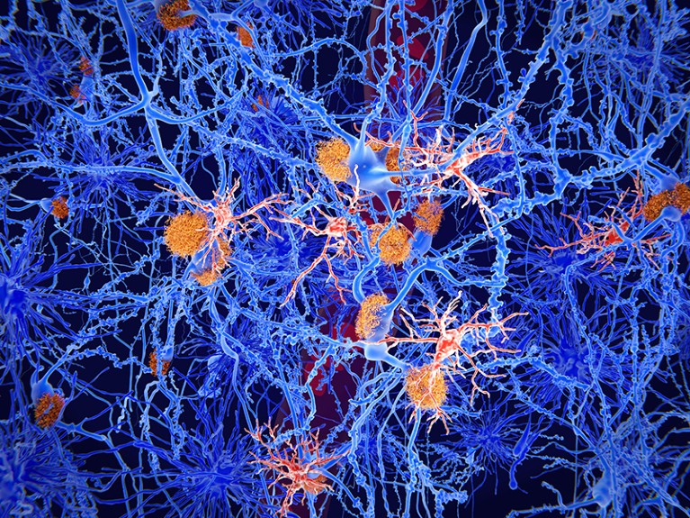 Microglia are specialised macrophages that restrain the accumulation of ß-amyloid plaques, shown here in orange.