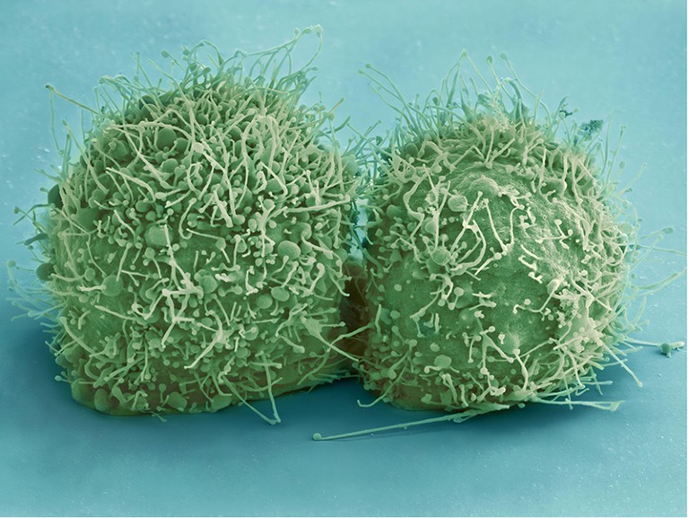 Scanning electron micrograph of just divided HeLa cells