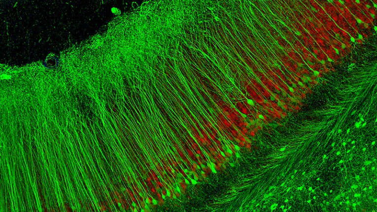 Fluorescent light micrograph of nerve cell fibres in the hippocampus of the brain of a mouse.