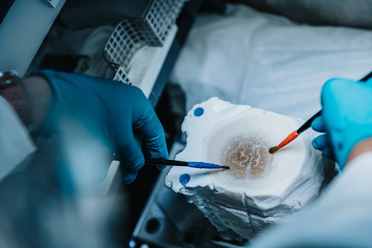 Preparation of a human donor brain at -50 °C prior to Polarized Light Imaging in a lab setting.