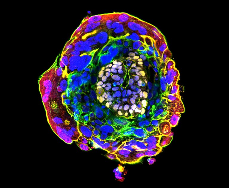 Immunofluorescence light micrograph of a ball of cells in bright colours on a black background