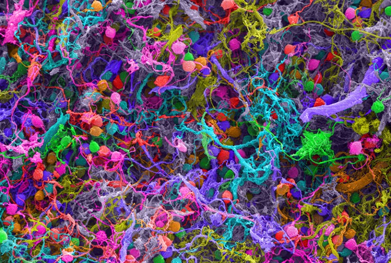Scanning electron micrograph of human brain cells.