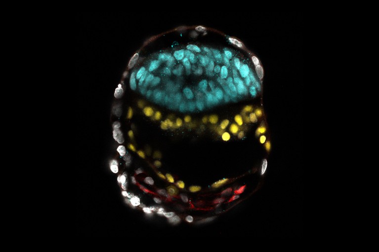 Microscopy image of a human post-implantation stem-cell-derived embryo model