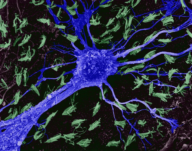 Coloured SEM of an astrocytic neuroglial cell.