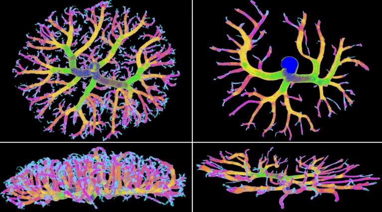 Representative feto-placental arterial vascular reconstructions by micro-computed tomography imaging.