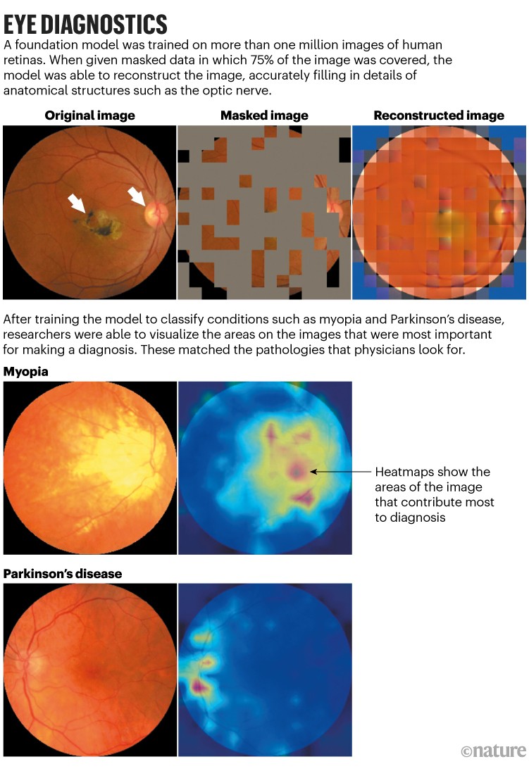 Eye diagnostics: Image reconstructions and heatmap images created by a model trained on one million images of human retinas.