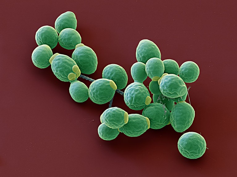 Coloured scanning electron micrograph of Candida albicans yeast cells.