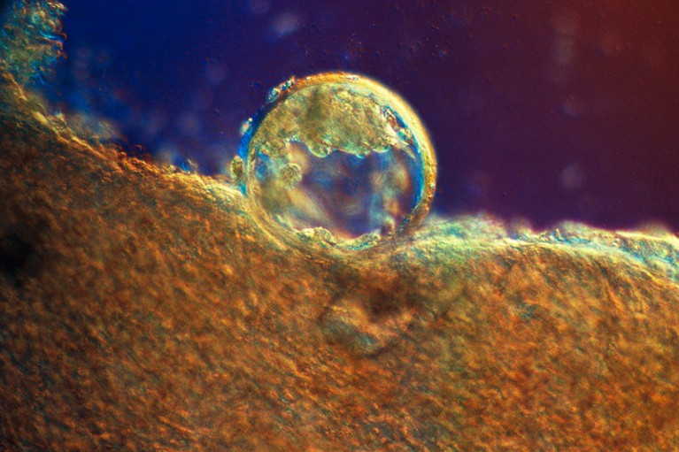 Light micrograph of a human blastocyst in the uterus three days after fertilisation.