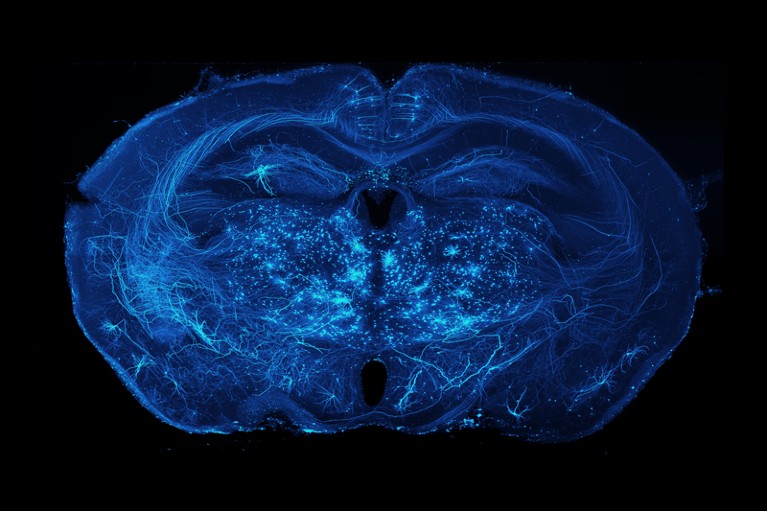 Brain-wide imaging of axonal projections in a mouse brain in blue on a black background