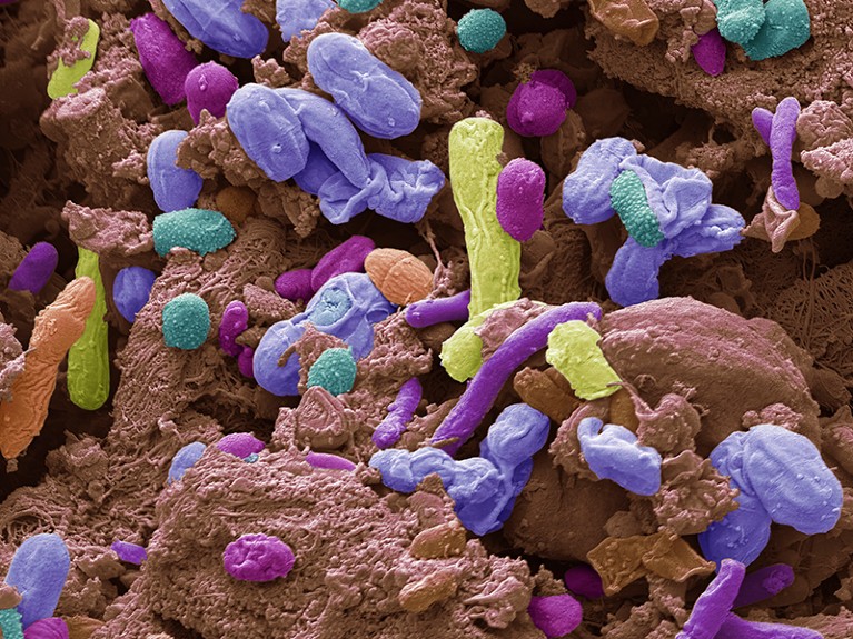 Gut bacteria. Scanning electron micrograph (SEM) of various bacteria found in a sample from a human small intestine.