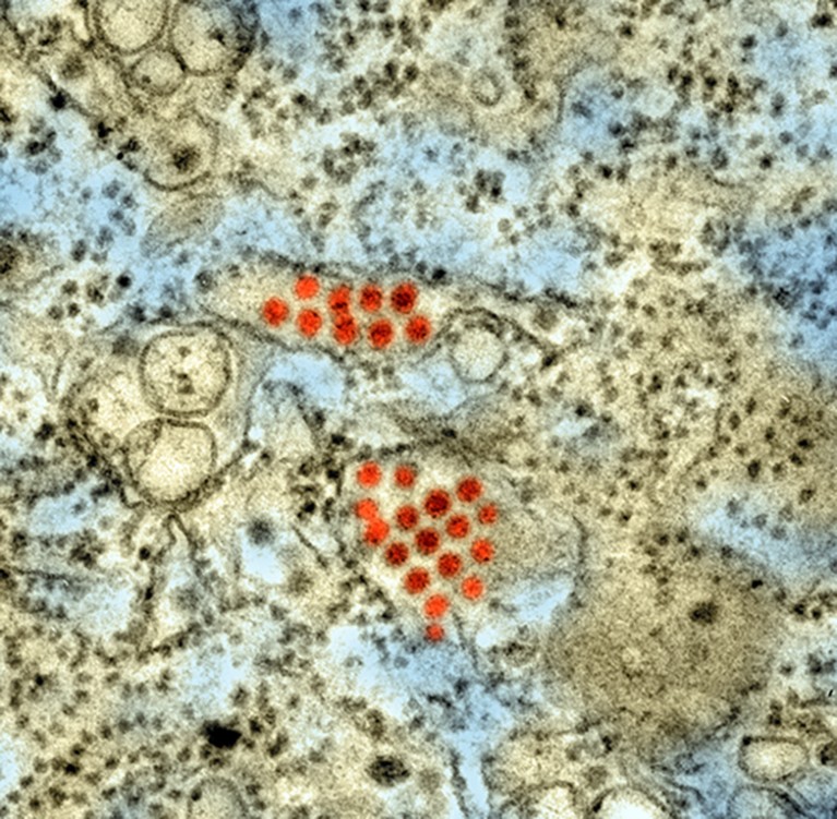 Colour-enhanced Transmission Electron Micrograph (TEM) showing a number of red round Dengue virus particles in a tissue specimen