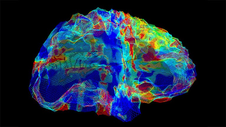 Brightly coloured MRI image of a brain.
