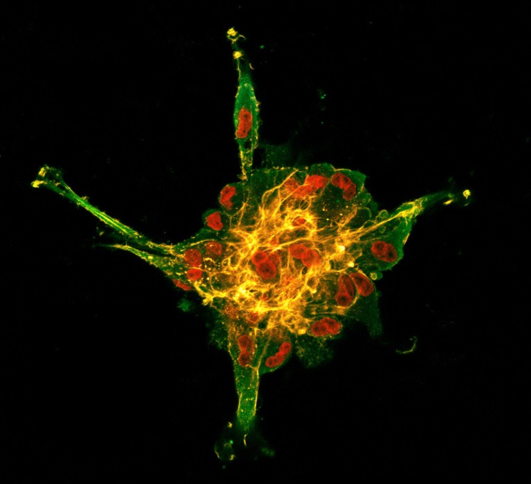 Dental pulp stem cells form a neurosphere as shown against Tuj1 (green), filamentous actin (orange) and nuclei (red).