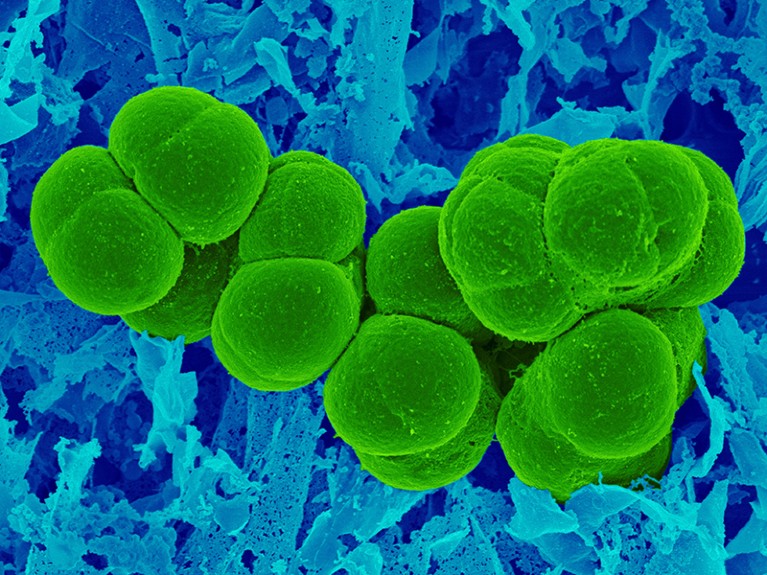 Coloured scanning electron micrograph showing a clump of green orbs against a background in varying shades of blue.