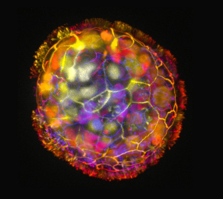 Immagine a colori di profondità che mostra la struttura multicellulare di un Anthrobot, circondato da ciglia sulla sua superficie.