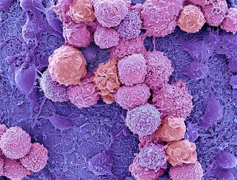 Coloured scanning electron micrograph of a neural organoid.