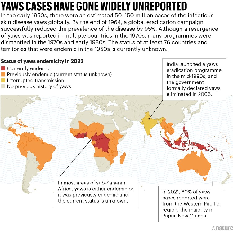 A world map shows a global eradication campaign successfully reduced the prevalence of the skin disease yaws globally by 95%.