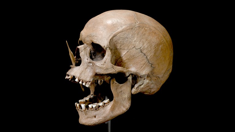 The Porsmose man skull from the Neolithic period, found in 1947 in Porsmose, Denmark.