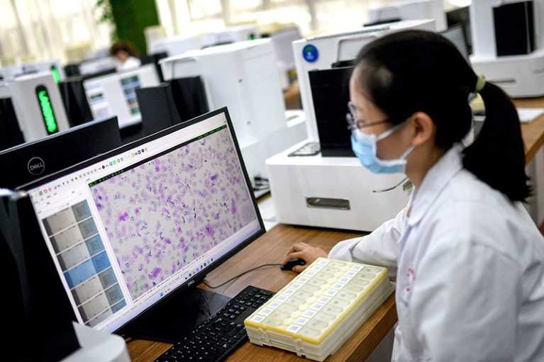 A laboratory technician conducting artificial intelligence based cervical cancer screening at a facility in China.