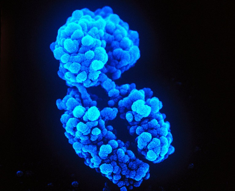 Uma micrografia eletrônica de varredura colorida de um cromossomo X em tons de azul sobre um fundo preto.