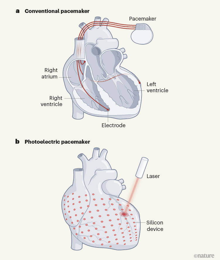 Light can restore a heart’s rhythm