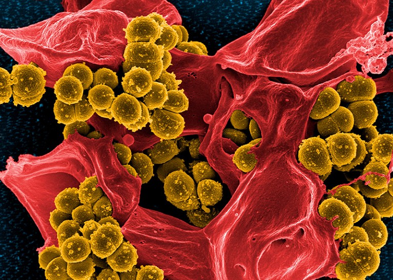Coloured SEM of methicillin-resistant Staphylococcus aureus bacteria (yellow) and a dead neutrophil white blood cell (red).