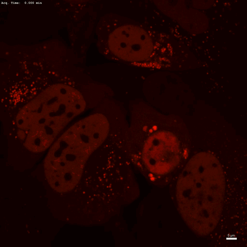 Moving image of phase separation happening in nuclei of human cells