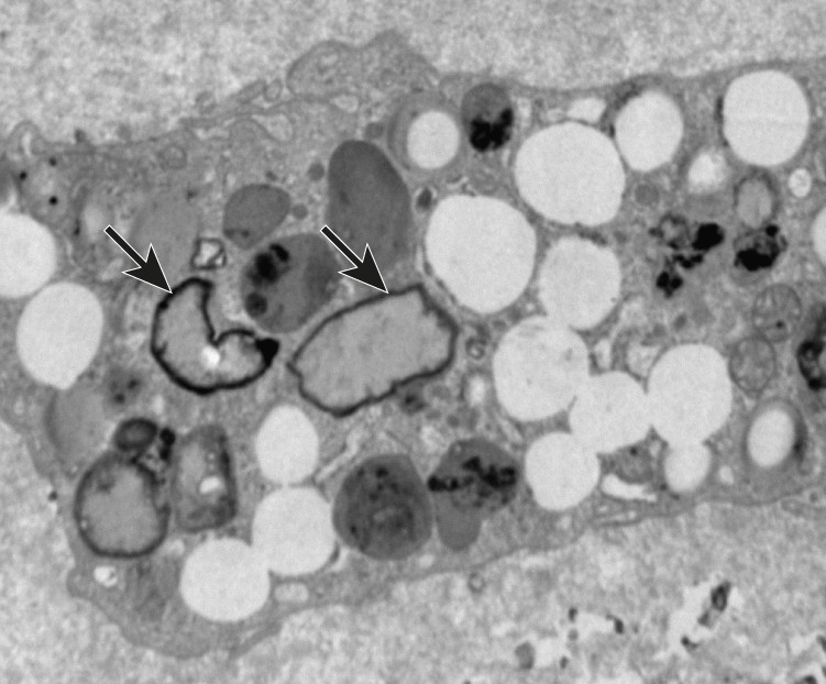Microscope image showing various black and white shapes, with arrows pointing to two jagged blobs.