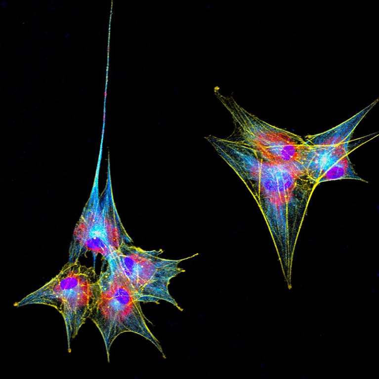 Microscopic photo of stained dental pulp stem cells differentiated into a neuronal lineage.